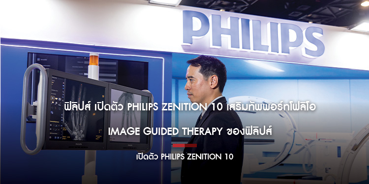 ฟิลิปส์ เปิดตัว Philips Zenition 10 เสริมทัพพอร์ทโฟลิโอ  Image Guided Therapy ของฟิลิปส์
