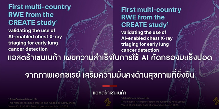 แอสตร้าเซนเนก้า เผยความสำเร็จในการใช้ AI คัดกรองมะเร็งปอดจากภาพเอกซเรย์ เสริมความมั่นคงด้านสุขภาพที่ยั่งยืน